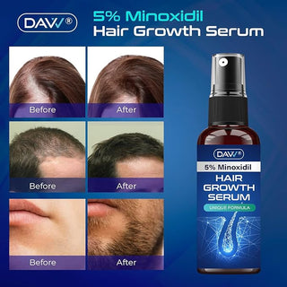 5% Minoxidil Hair Growth Serum for Men and with Biotin Hair Regrowth Treatment for Stronger Thicker Longer Hair Help to Stop Thinning and Loss Hair 60Ml 1 Month Supply